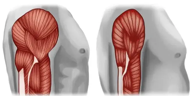 La Sarcopenia